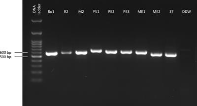 Antagonistic interactions between maize seeds microbiome species and the late wilt disease agent, Magnaporthiopsis maydis